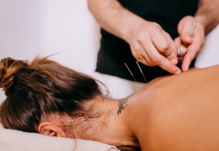 Quels sont les autres outils de l'acupuncteur ? (moxas,.)